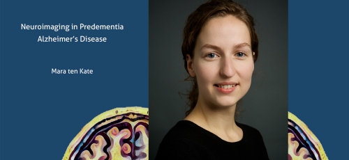 Promotie: Neuroimaging in predementia Alzheimer’s disease