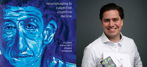 Promotie: Neuroimaging in Subjective Cognitive Decline