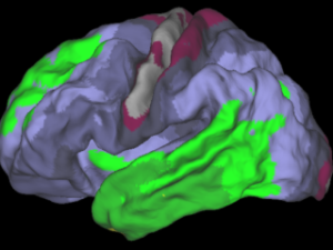 20 jaar onderzoek naar alzheimer 1