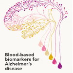 Promotie Lies Thijssen: Bloedtest om de ziekte van Alzheimer op te sporen