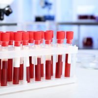 Subsidie voor versnellen van gebruik bloedtest in de praktijk om alzheimer vast te stellen