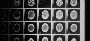 Afbeelding CT scan (rechtenvrij)