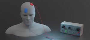 Stimulating thoughts – Symposium on non-invasive brain stimulation in neuropsychiatric disease 15 May 2025