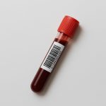 Bloedtest