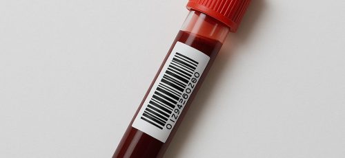 Bloedtest